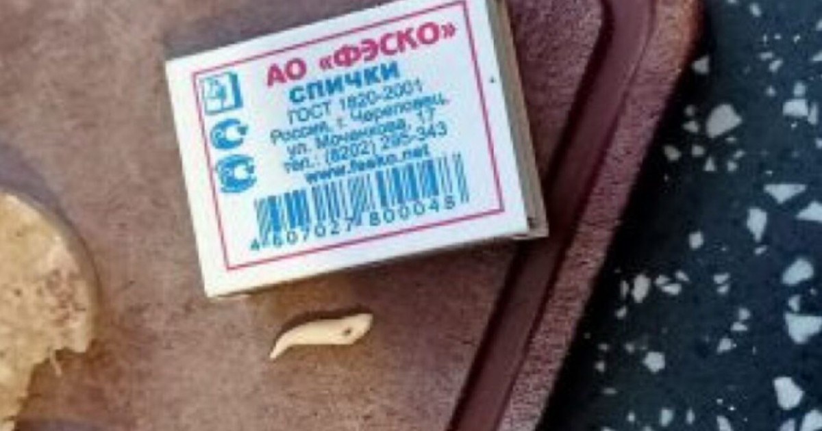 Қарағанды тұрғыны шұжықтың ішінен тіс тауып алды
