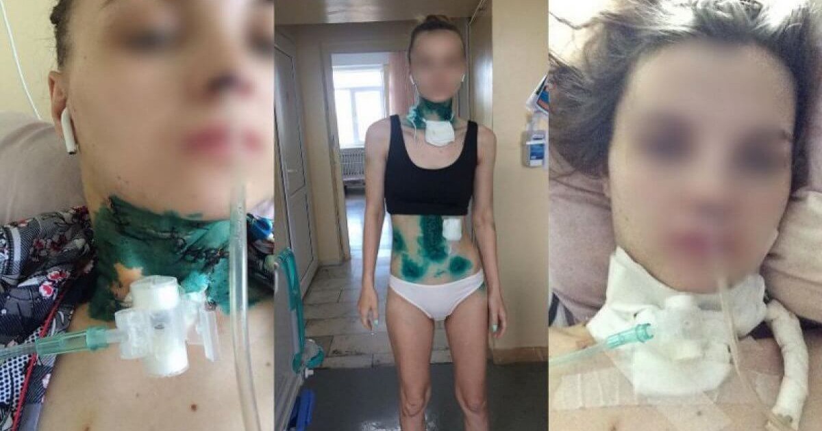 «Бауыздамақшы болған»: Алматыда әйелін пышақтаған адам сотталды
