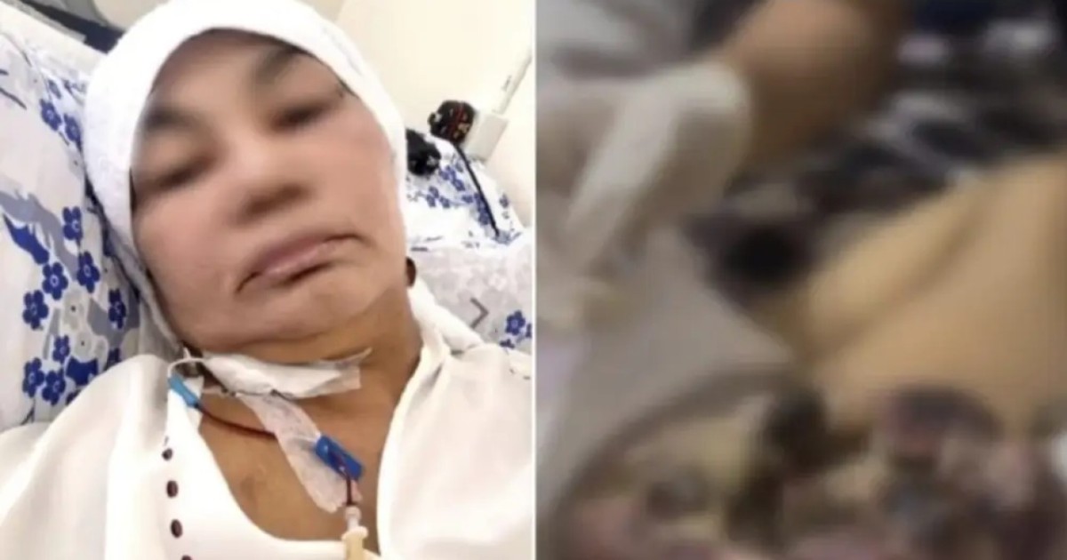 Грыжа деп айтқан, бірақ рак болып шықты: дәрігерлердің салғырттығы ма?