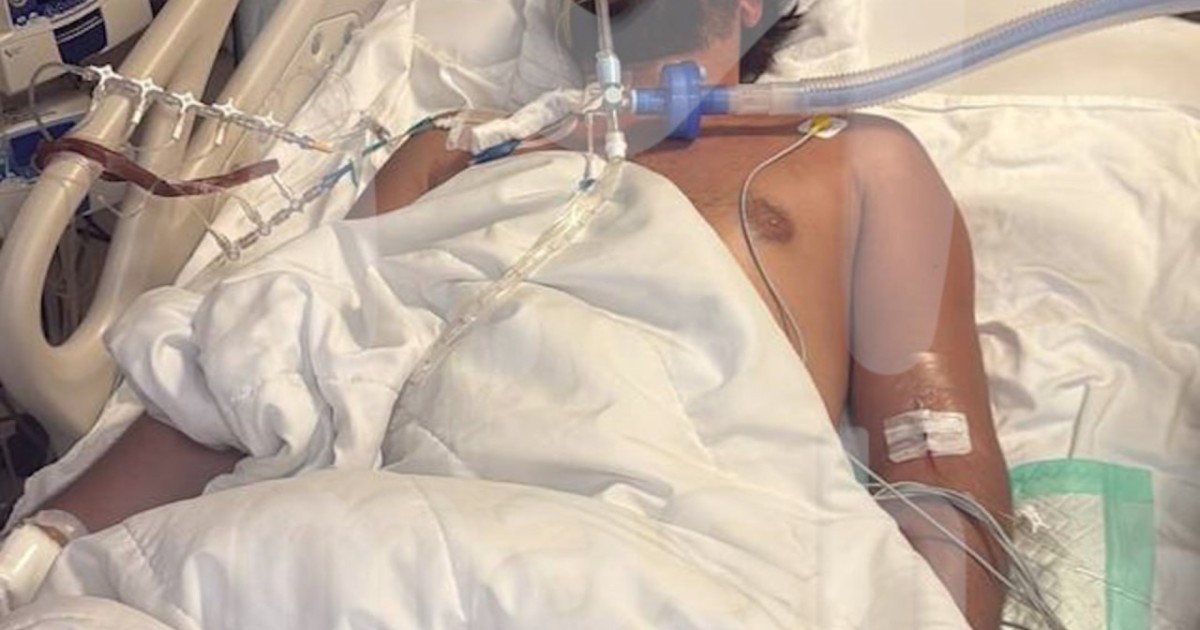 Мән бермеген: 32 жастағы жігіт улы жылан шаққан соң қайтыс болды