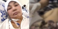 Грыжа деп айтқан, бірақ рак болып шықты: дәрігерлердің салғырттығы ма?