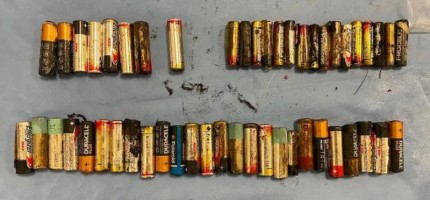 66 жастағы әйелдің асқазанынан 55 батарея алынды