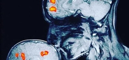 Ана мен баланың миындағы таңғажайып құбылыстың сыры ашылды