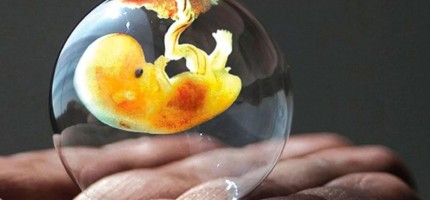 30 жыл бұрын мұздатылған эмбриондардан егіздер дүниеге келді