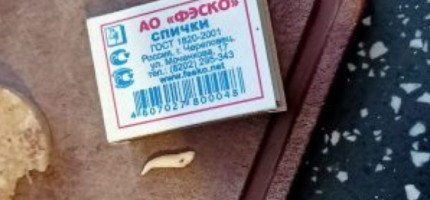 Қарағанды тұрғыны шұжықтың ішінен тіс тауып алды