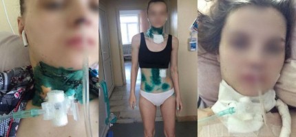 «Бауыздамақшы болған»: Алматыда әйелін пышақтаған адам сотталды