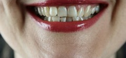 Дәрігер ауыз қуысынан жағымсыз иіс шығуының себептерін атады