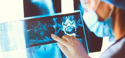 Қазақстанда қатерлік ісікпен ауыратындар саны артқан