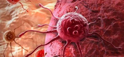Рак ауруының басты белгісі стресс пе? – ғылыми дәлел бар