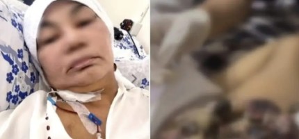 Грыжа деп айтқан, бірақ рак болып шықты: дәрігерлердің салғырттығы ма?
