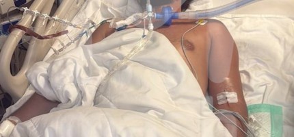 Мән бермеген: 32 жастағы жігіт улы жылан шаққан соң қайтыс болды