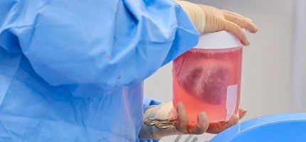 Адамға шошқаның жүрегін салуға бола ма?