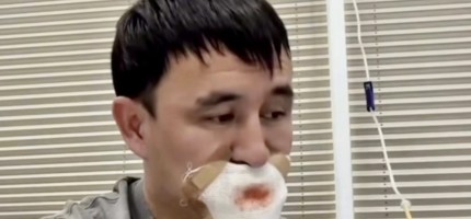 Қызбен сүйісемін деп тілінен айрылып қалған жігіт туралы сұмдық хабар тарады