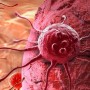 Рак ауруының басты белгісі стресс пе? – ғылыми дәлел бар